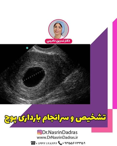 تشخیص بارداری پوچ چگونه انجام می گردد؟