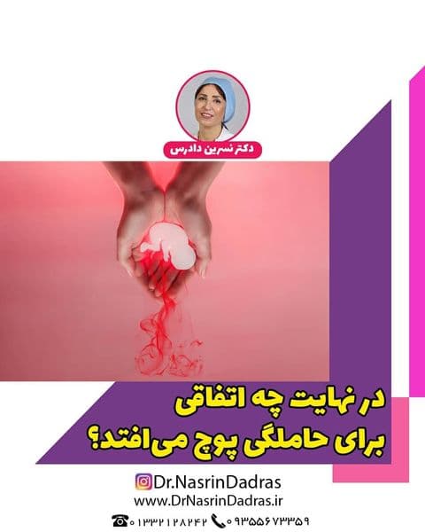 در نهایت چه اتفاقی برای حاملگی پوچ میافتد؟